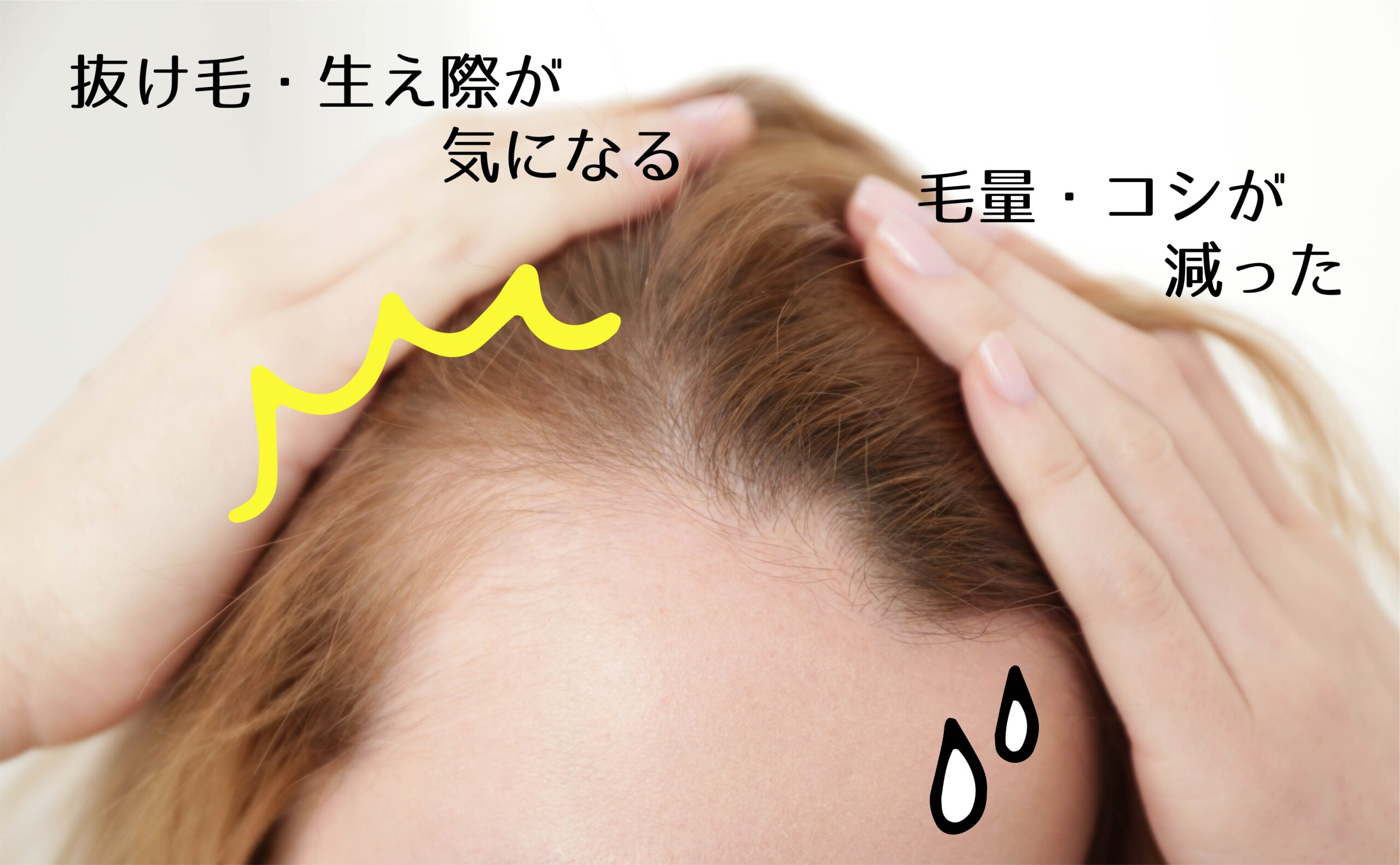 薄毛・抜け毛、頭皮のお悩み